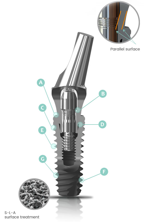 Implants_BASS Medical Group